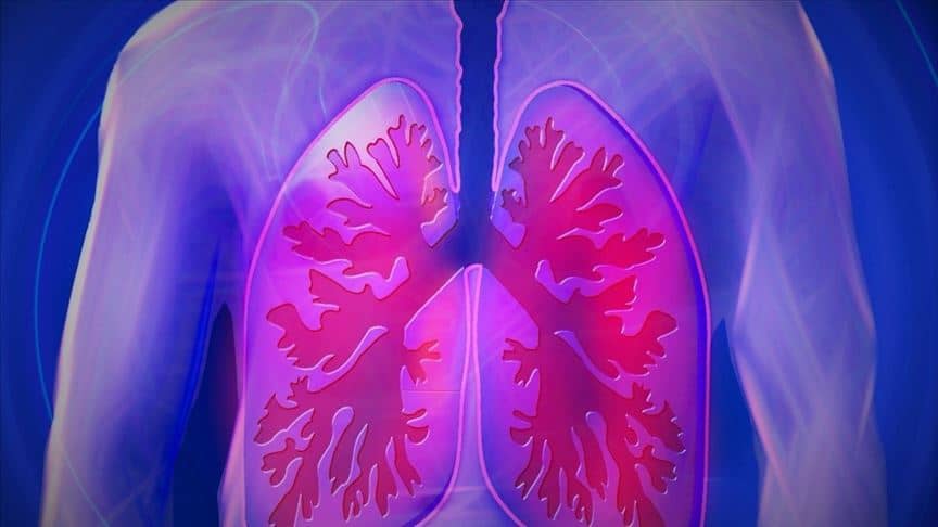 Çağın bir diğer pandemisi: Akciğer kanseri