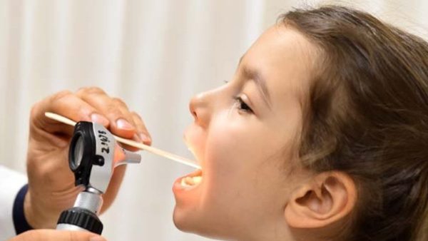 Strep A kâbusu büyüyor… Bilim Kurulu üyesinden korkutan uyarı! Bu belirtilere dikkat