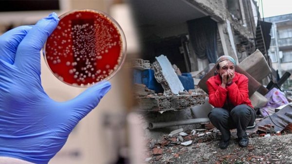 Depremin vurduğu Hatay’da ‘gaita testi’ önlemi! Gaita testi nedir ne için yapılır?