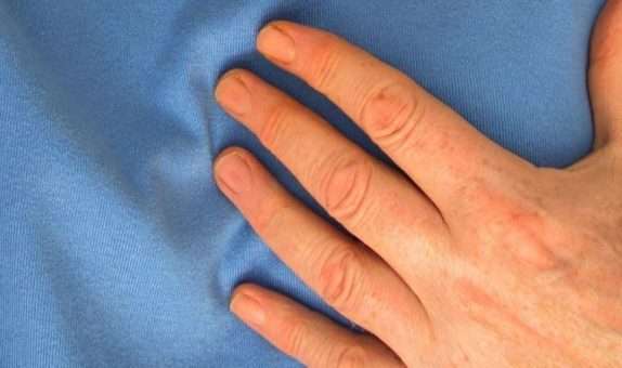 Sıcak havalar en çok kalp hastaları için riskli