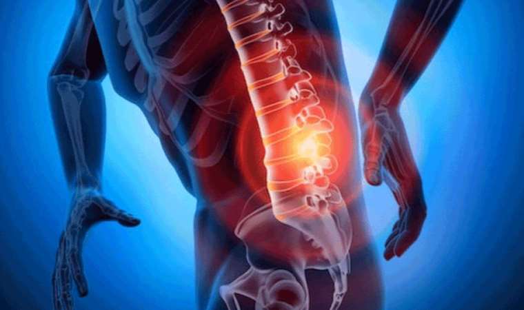 ‘Tedavi edilmeyen kasık fıtığı sindirimi vurabilir’