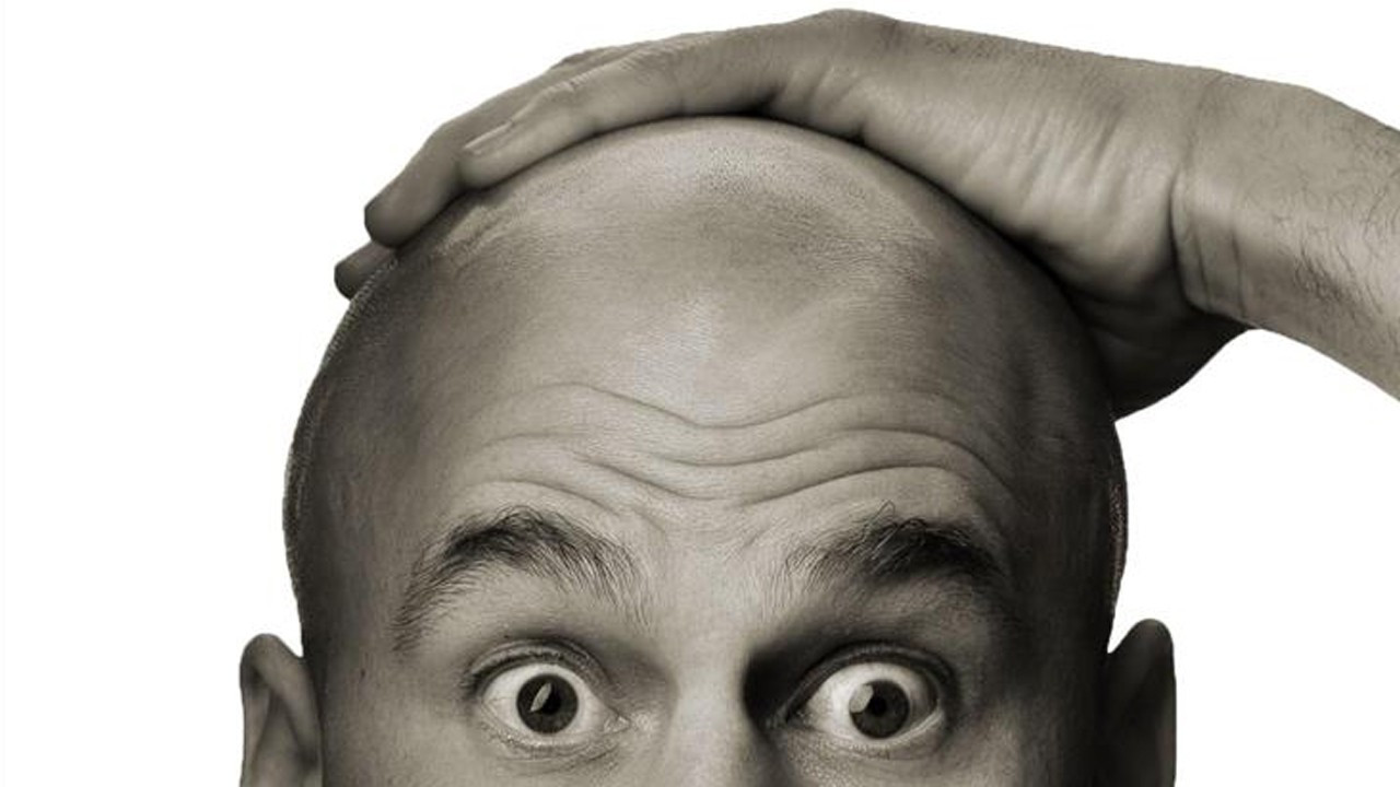 TÜRSAB: Türkiye’ye saç ekimi için gelenlerin sayısı yüzde 20 artacak