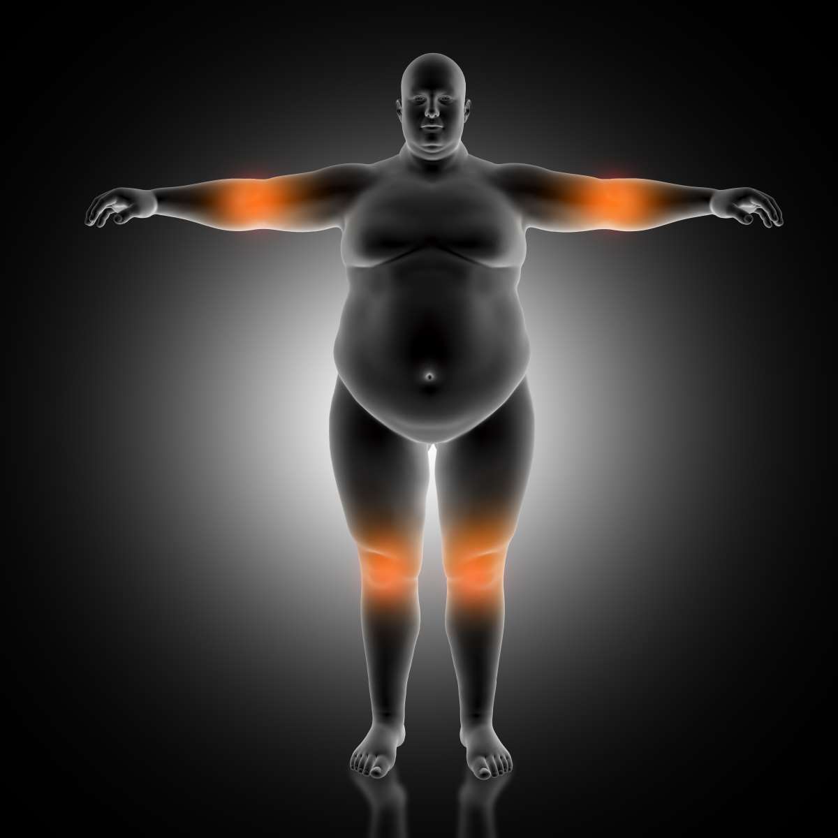 Türkiye'nin Obezite Sorunu: Uzmanlar Alarm Veriyor