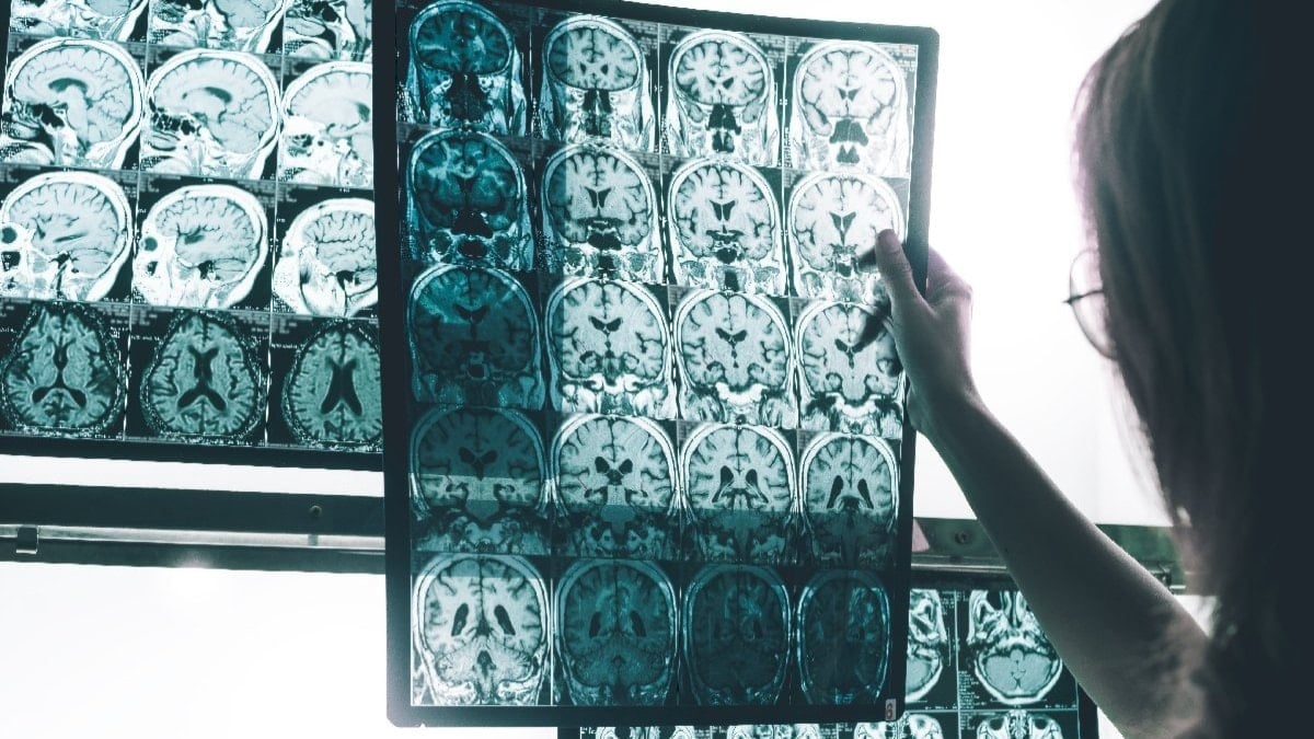 Atrofi nedir, belirtileri neler?