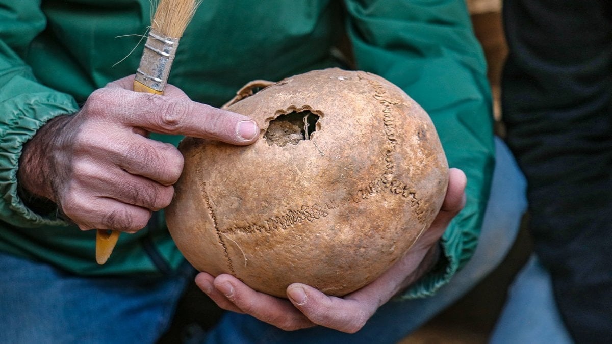 vanda 3 bin 200 yil oncesine ait beyin ameliyati izine rastlandi MkQgZJ2V
