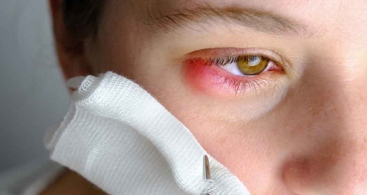 Gözleri kanatan ölümcül virüs salgını: 8 kişi öldü, işte belirtiler