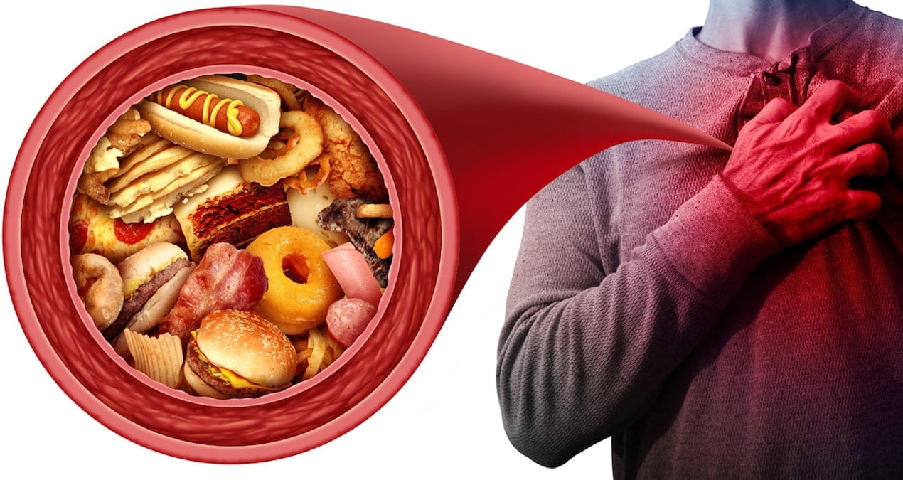 Kalp sağlığınızı koruyun: Uzak durmanız gereken 4 besin