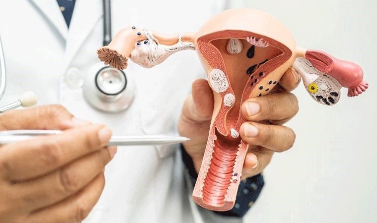 Sağlık için bir dakika: ‘Smear testini ihmal etmeyin’