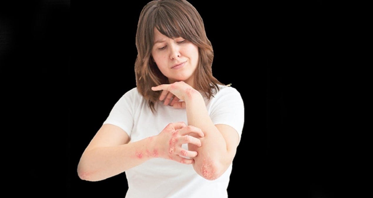 Vücudunuzda uyuyan virüse dikkat