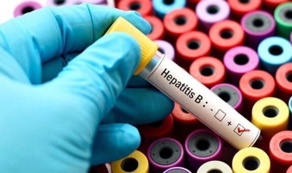 Korkutan ‘Hepatit B’ verisi: Yılda 1 milyon ölüm!