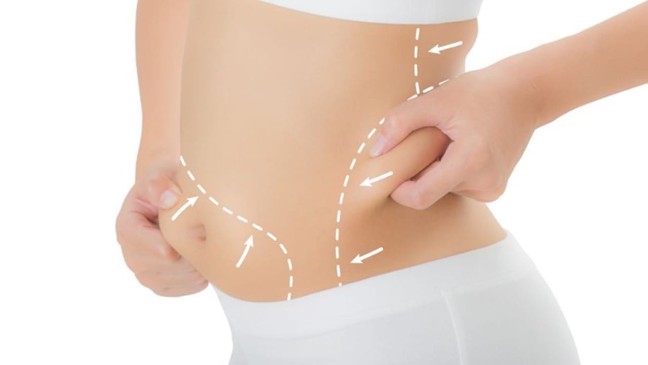 Liposuction ile Hayal Ettiğiniz Vücuda Kavuşun