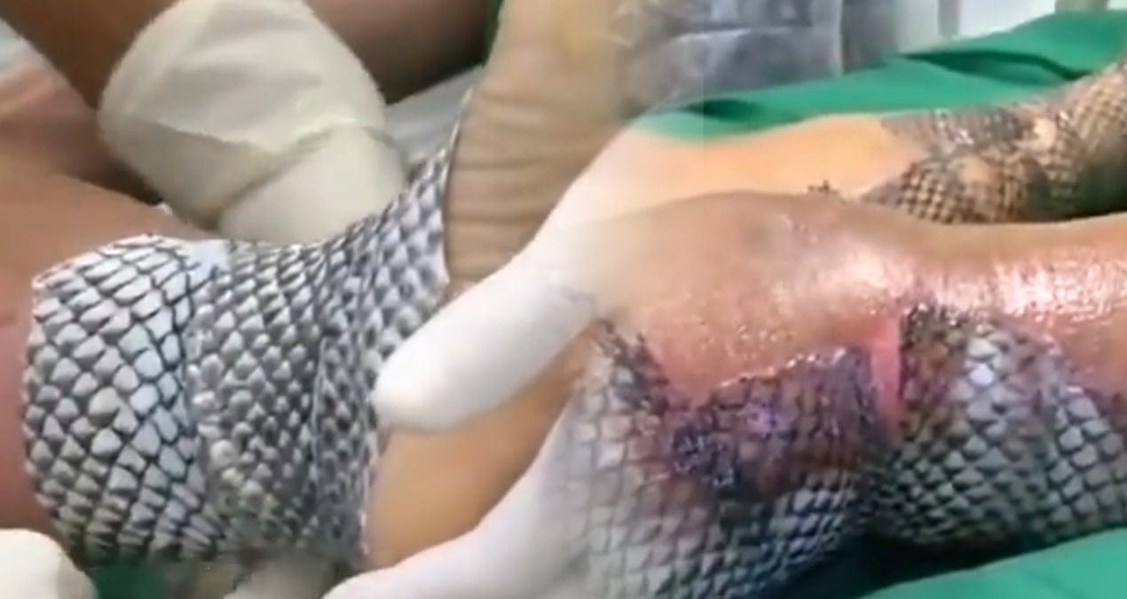 En zorlu tedavilerden birini Brezilyalılar çözdü: Tuhaf görünmesine rağmen sonuçları çok başka