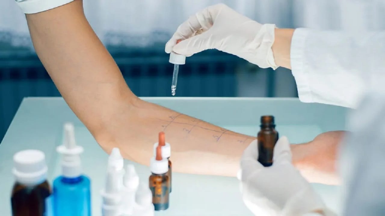 Alerji Testi ile Alerjik Belirtilerinize Son Verin