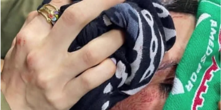 Bodrum Kadın Platformu’ndan Bodrumspor – Amedspor Maçı Sonrası Şiddete Tepki