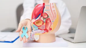 Prostat kanseri riskini artıran 3 temel faktör: Obezite, hareketsizlik ve yanlış beslenme